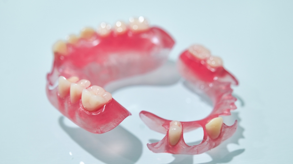 before and after partial dentures