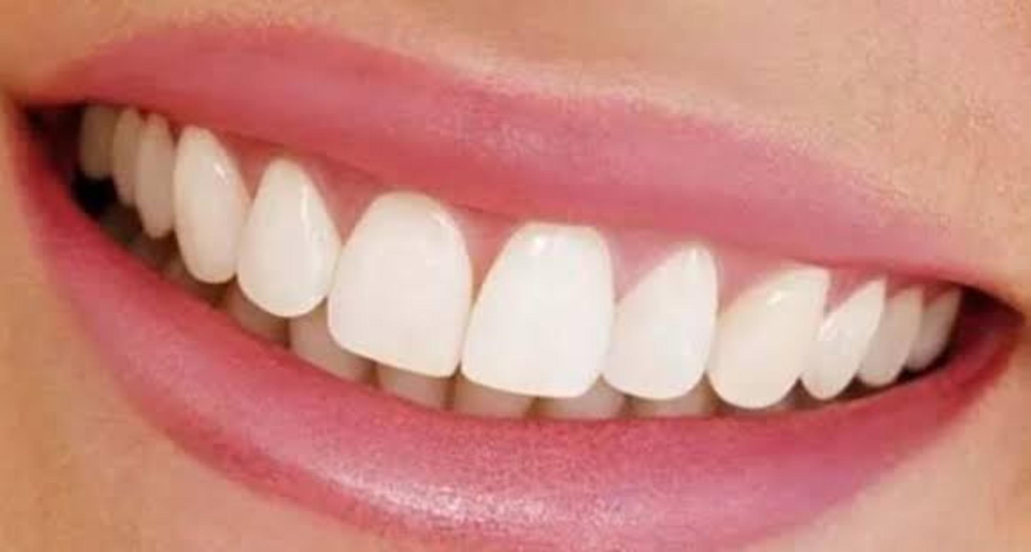 pictures of dentures that look real